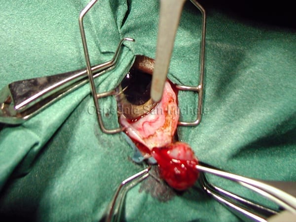 Asportazione neoplasia terza palpebra con laser