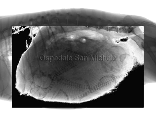 Radiografia di un utero gravido