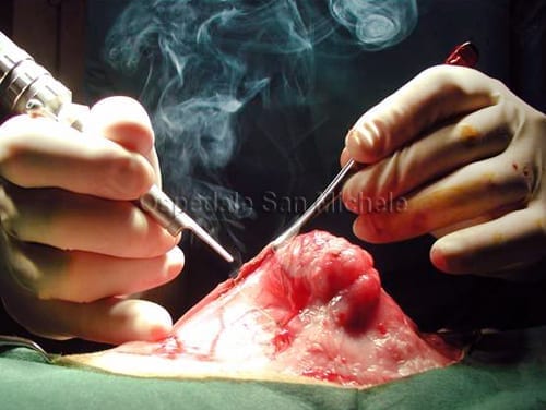 Rimozione di un fibrosarcoma in un gatto mediante laser