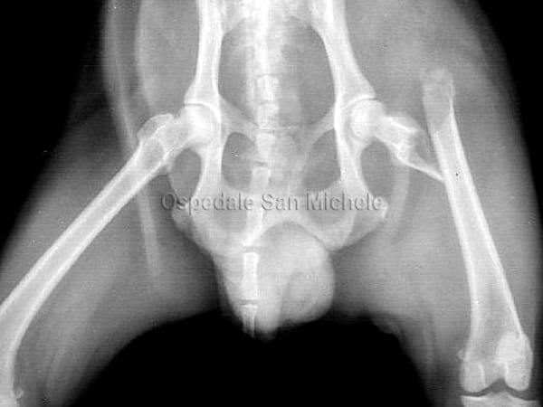 Osteosintesi femorale preoperatoria
