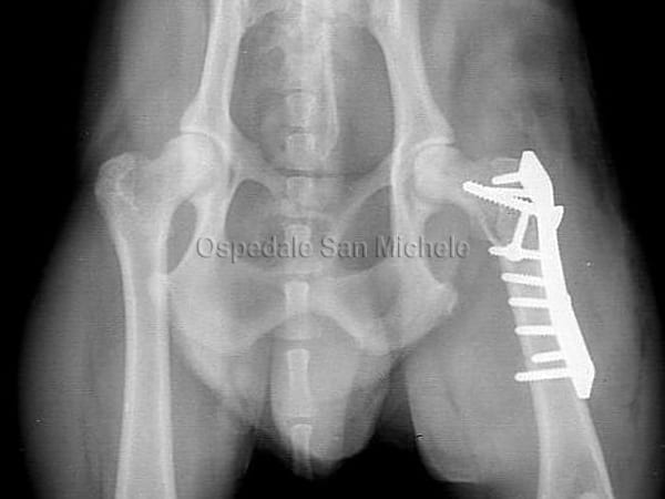 Osteosintesi femorale postoperatoria