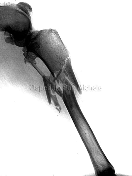 frattura_tibia_cane1