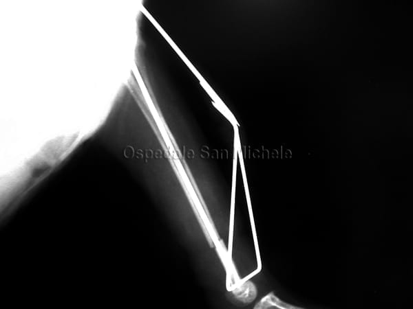 Radiografia della frattura riparata della tibia di un pappagallo