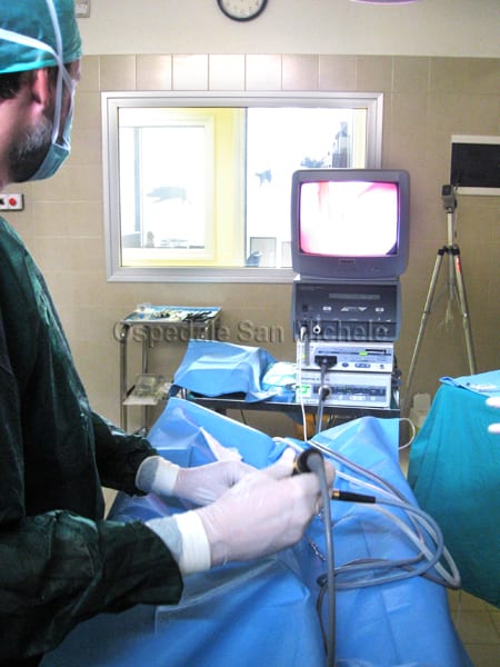 Laparoscopia